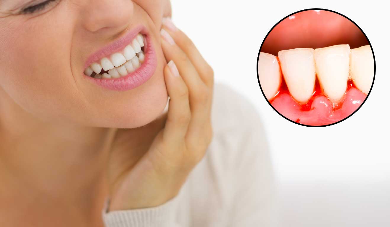 Afecțiunea dentară care crește riscul de a te îmbolnăvi de o formă gravă de COVID-19. Concluziile uimitoare ale unui studiu recent