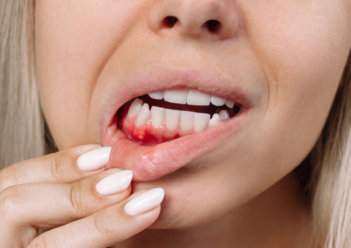 Ce greșeli faci când te speli pe dinți și provoci retragerea gingiilor